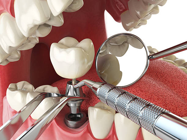 Best Emergency Dental Care for Abscessed Tooth in High Point, NC